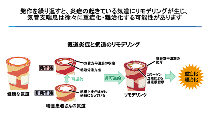 速やかな抗炎症治療の重要性